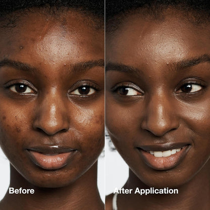 Clinique Even Better Makeup Medium Coverage Foundation Broad Spectrum SPF 15 | Evens Skin Tone + Reduces Dark Spots